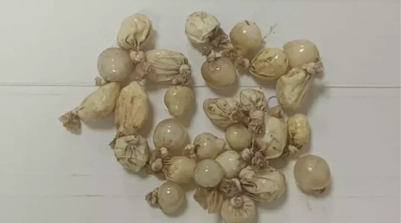 Kocaeli'de Alkollü Sürücünün Midesinden 100 Gram Kokain Bulundu
