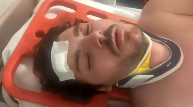Trafik Tartışması Sonrası Darp Edilen Oyuncu: 'Ölecektim'
